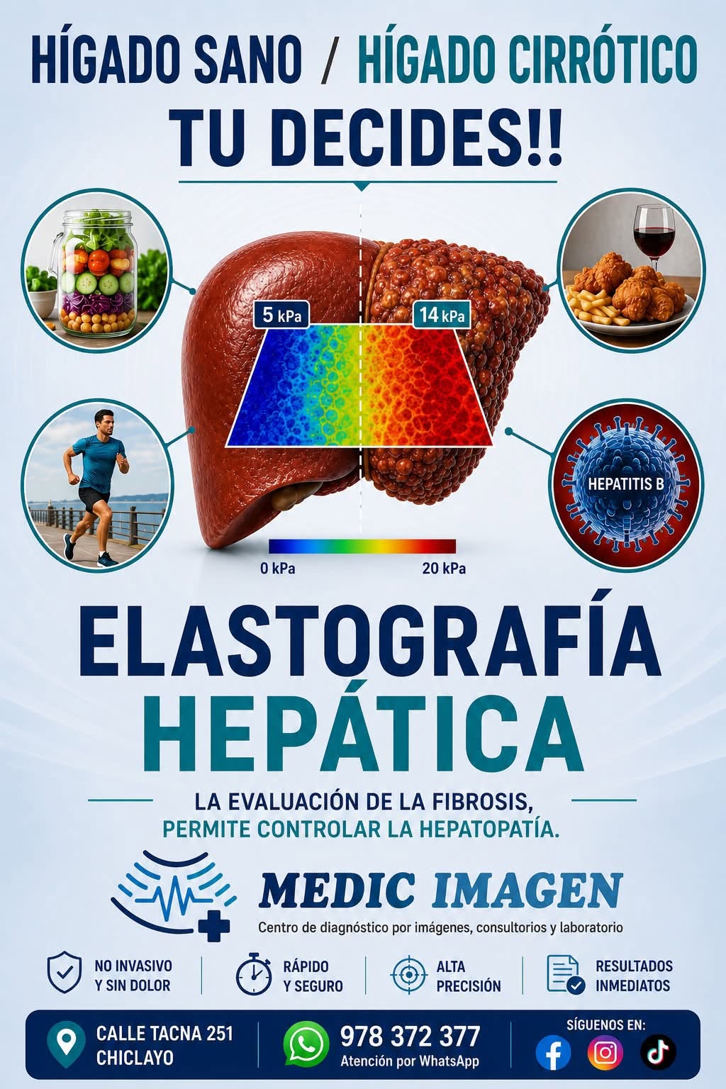 Elastografía Hepática